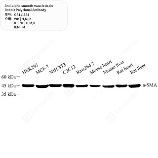 Антитела первичные, поликл. кролика к alpha smooth muscle Actin крысы, мыши, человека, 50 мкл