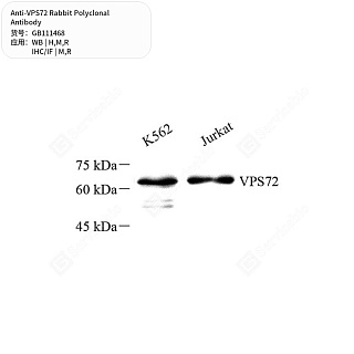 Антитела первичные, поликлональные кролика к VPS72 крысы, мыши, человека, 50 мкл