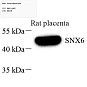 Антитела первичные, поликлональные, Snx6, 100 мкл