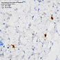 Антитела первичные, моноклональные, Mast cell tryptase, 100 мкл