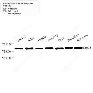 Антитела первичные, поликлональные кролика к Grp75/MOT крысы, мыши, человека, 50 мкл