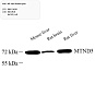 Антитела первичные, поликлональные, MT-ND5, 100 мкл