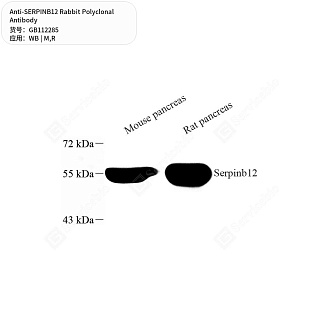 Антитела первичные, поликлональные кролика к SERPINB12 крысы, мыши, 50 мкл