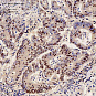 Антитела первичные, поликлональные, BRCA2, 100 мкл