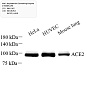 Антитела первичные, поликлональные, Angiotensin Converting Enzyme 2, 50 мкл