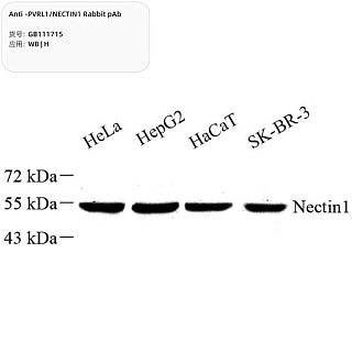 Антитела первичные, поликлональные кролика к PVRL1/NECTIN1 человека, 100 мкл