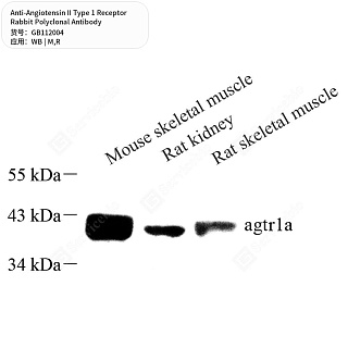 Антитела первичные, поликлональные кролика к Angiotensin II Type 1 Receptor крысы, мыши, 50 мкл