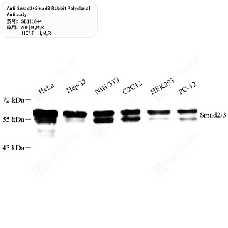 Антитела первичные, поликлональные кролика к Smad2+Smad3 крысы, мыши, человека, 50 мкл