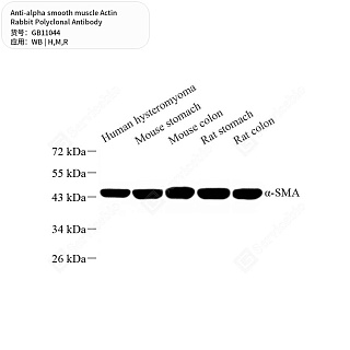 Антитела первичные, поликл. кролика к alpha smooth muscle Actin крысы, мыши, человека, 50 мкл