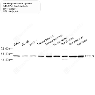 Антитела первичные, поликл. кролика к Elongation factor 1-gamma крысы, мыши, человека, 50 мкл