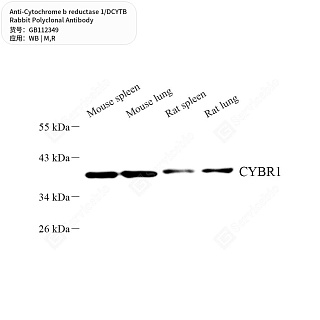Антитела первичные, поликлональные кролика к Cytochrome b reductase 1/DCYTB крысы, мыши, 50 мкл