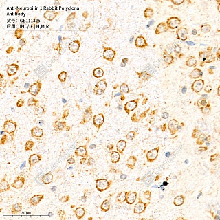Антитела первичные, поликлональные кролика к Neuropilin 1 крысы, мыши, человека, 50 мкл