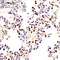 Антитела первичные, поликлональные, Telomerase reverse transcriptase, 100 мкл