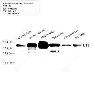 Антитела первичные, поликлональные кролика к Lactoferrin крысы, мыши, 50 мкл