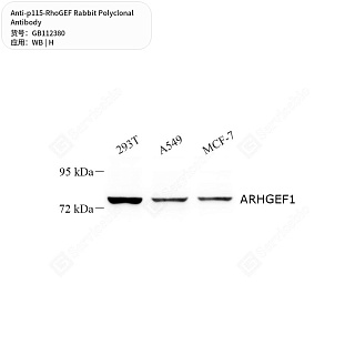 Антитела первичные, поликлональные кролика к p115-RhoGEF человека, 50 мкл