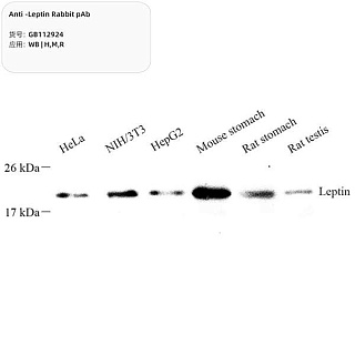 Антитела первичные, поликлональные кролика к Leptin крысы, мыши, человека, 100 мкл