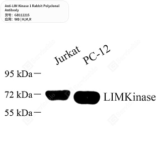 Антитела первичные, поликлональные кролика к LIM Kinase 1 крысы, мыши, человека, 50 мкл