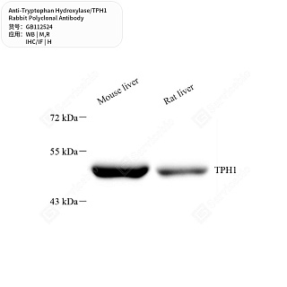 Антитела первичные, поликл. кролика к Tryptophan Hydroxylase/TPH1 крысы, мыши, человека, 50 мкл
