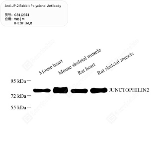 Антитела первичные, поликлональные кролика к JP-2 крысы, мыши, 50 мкл