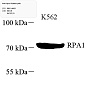 Антитела первичные, поликлональные, Rpa1, 100 мкл