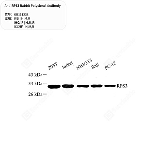Антитела первичные, поликлональные кролика к RPS3 крысы, мыши, человека, 50 мкл