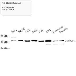 Антитела первичные, поликлональные кролика к CSNK2A1 крысы, мыши, человека, 100 мкл