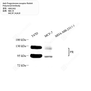 Антитела первичные, поликлональные кролика к Progesterone receptor крысы, мыши, человека, 50 мкл