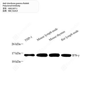 Антитела первичные, поликлональные кролика к Interferon gamma крысы, мыши, человека, 50 мкл