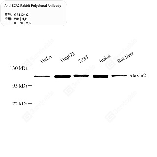 Антитела первичные, поликлональные кролика к SCA2 крысы, мыши, человека, 50 мкл