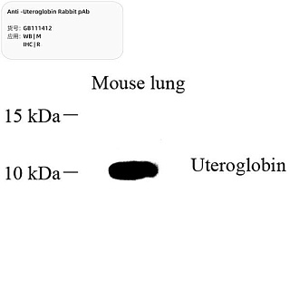 Антитела первичные, поликлональные кролика к Uteroglobin крысы, мыши, 100 мкл