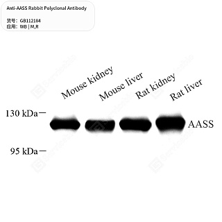 Антитела первичные, поликлональные кролика к AASS крысы, мыши, 50 мкл