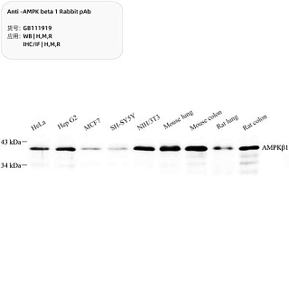 Антитела первичные, поликлональные кролика к AMPK beta 1 крысы, мыши, человека, 100 мкл