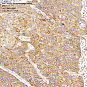 Антитела первичные, поликлональные, Insulin Receptor alpha, 100 мкл