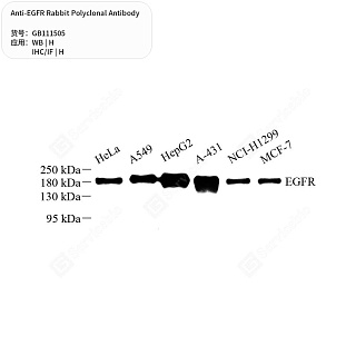 Антитела первичные, поликлональные кролика к EGFR человека, 50 мкл
