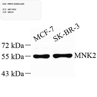 Антитела первичные, поликлональные кролика к MNK2 человека, 100 мкл