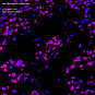 Антитела первичные, поликлональные, Neuropilin 1, 100 мкл