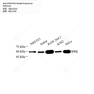 Антитела первичные, поликлональные кролика к IPPK/IPK1 мыши, человека, 50 мкл