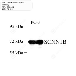 Антитела первичные, поликлональные кролика к SCNN1B мыши, человека, 50 мкл