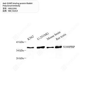 Антитела первичные, поликлональные кролика к S100P binding protein крысы, мыши, человека, 50 мкл