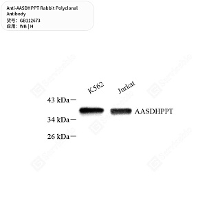 Антитела первичные, поликлональные кролика к AASDHPPT человека, 50 мкл