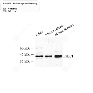 Антитела первичные, поликлональные кролика к IGBP1 мыши, человека, 50 мкл