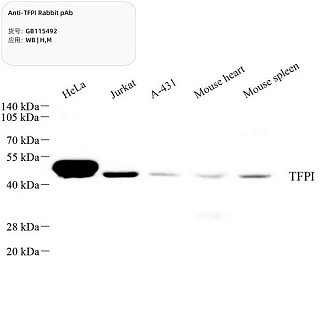 Антитела первичные, поликлональные кролика к TFPI мыши, человека, 100 мкл