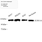 Антитела первичные, поликлональные, ZC3H11A, 100 мкл