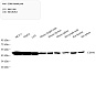 Антитела первичные, поликлональные, CCR6, 100 мкл