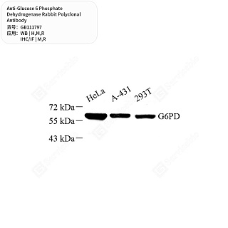 Антитела первичные, пол. кролика к Glucose 6 Phosphate Dehydrogenase крысы, мыши, человека, 50 мкл
