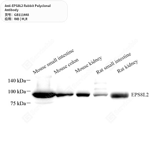 Антитела первичные, поликлональные кролика к EPS8L2 крысы, мыши, 50 мкл