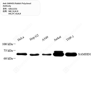 Антитела первичные, поликлональные кролика к SAMHD1 крысы, мыши, человека, 50 мкл
