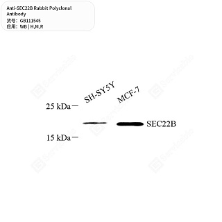 Антитела первичные, поликлональные кролика к SEC22B крысы, мыши, человека, 50 мкл