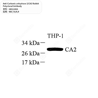 Антитела первичные, поликлональные кролика к Carbonic anhydrase 2/CA2 крысы, мыши, человека, 50 мкл
