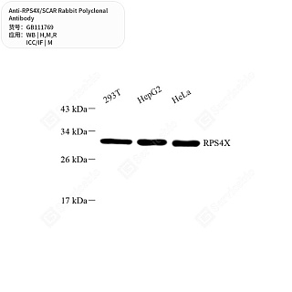 Антитела первичные, поликлональные кролика к RPS4X/SCAR крысы, мыши, человека, 50 мкл